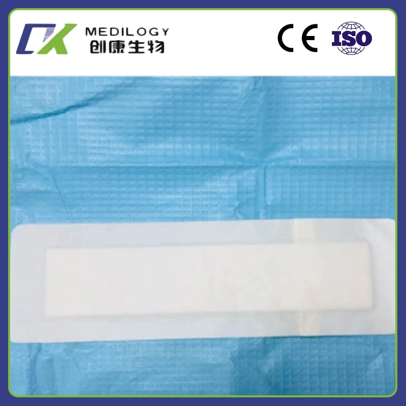 Material Hydrocolloid Dressing for Primarily Heel or Elbow Band Aid Wound Dressing Medical Care Wholesale Price