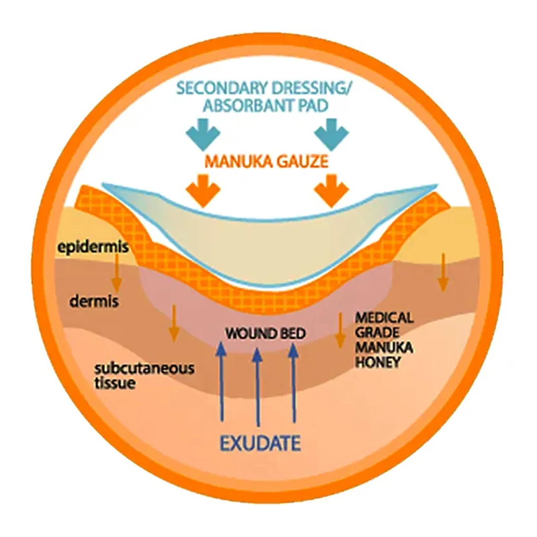 Wound Care Dressings Honey Gauze Dressing
